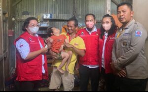 Pemkab Lamsel Fasilitasi Perawatan Bocah Penderita Hidrosefalus di Desa Rangai Tritunggal